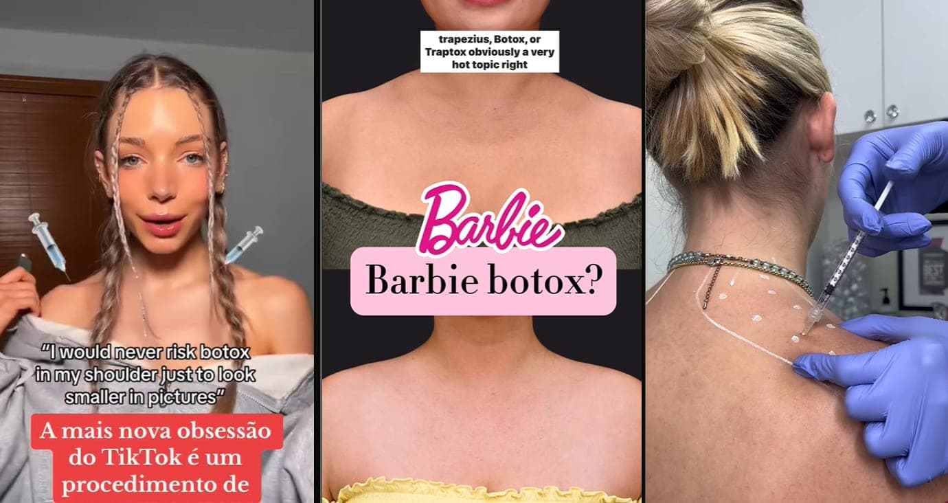 Kas tas Barbės botoksas ir kodėl gydytojai sunerimę?