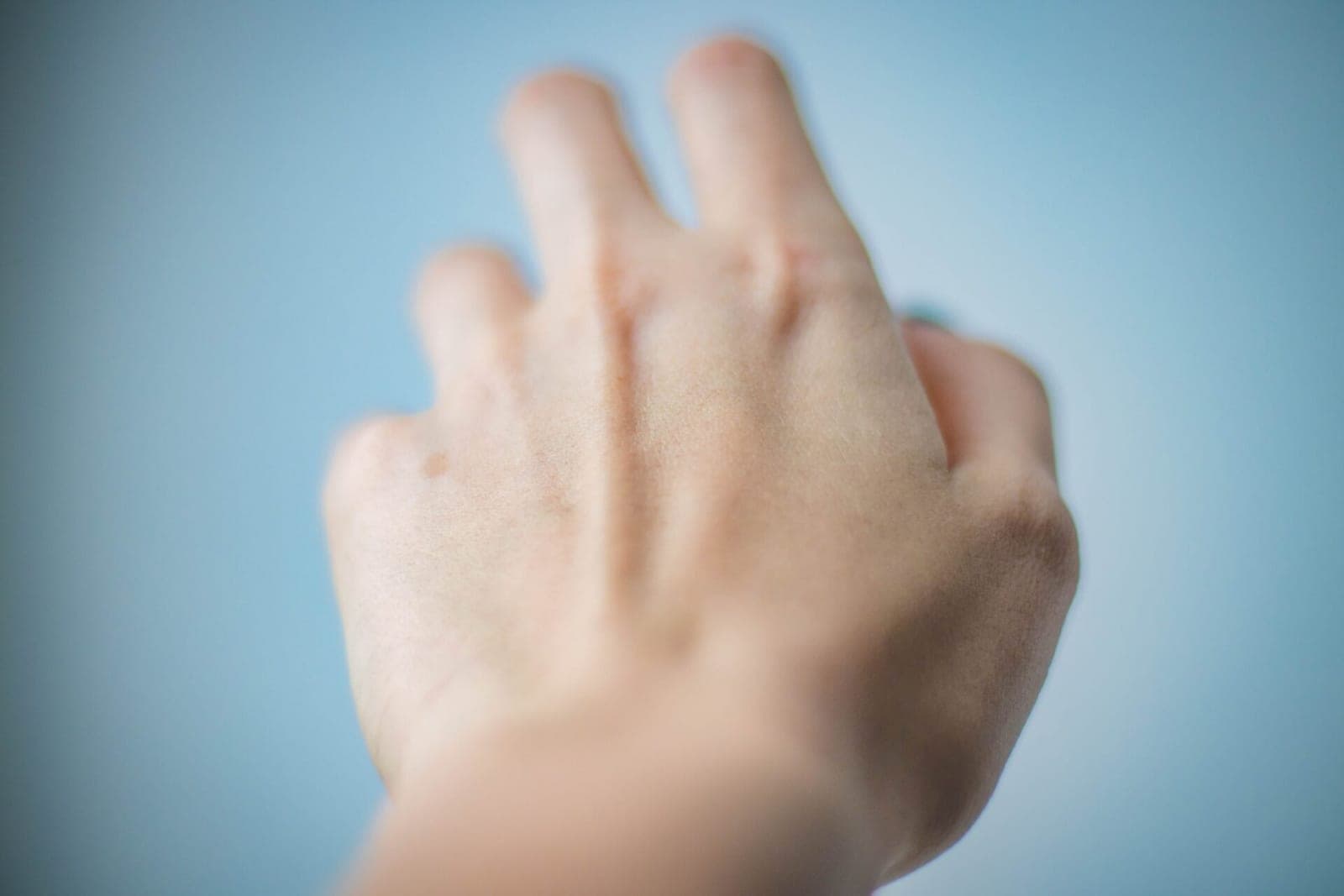 Dirbtinis intelektas gali itin tiksliai nustatyti melanomos atvejus
