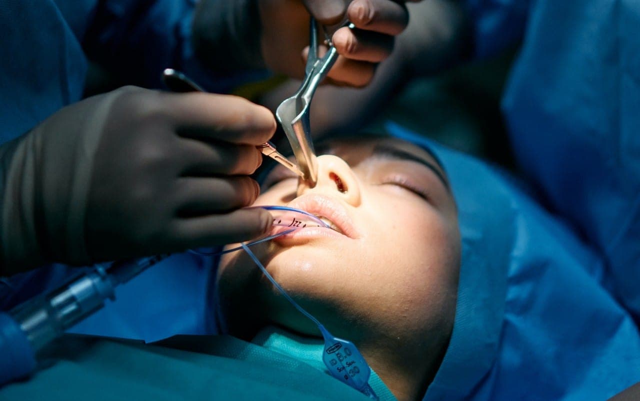 Rinoplastika: efektas ir grėsmės