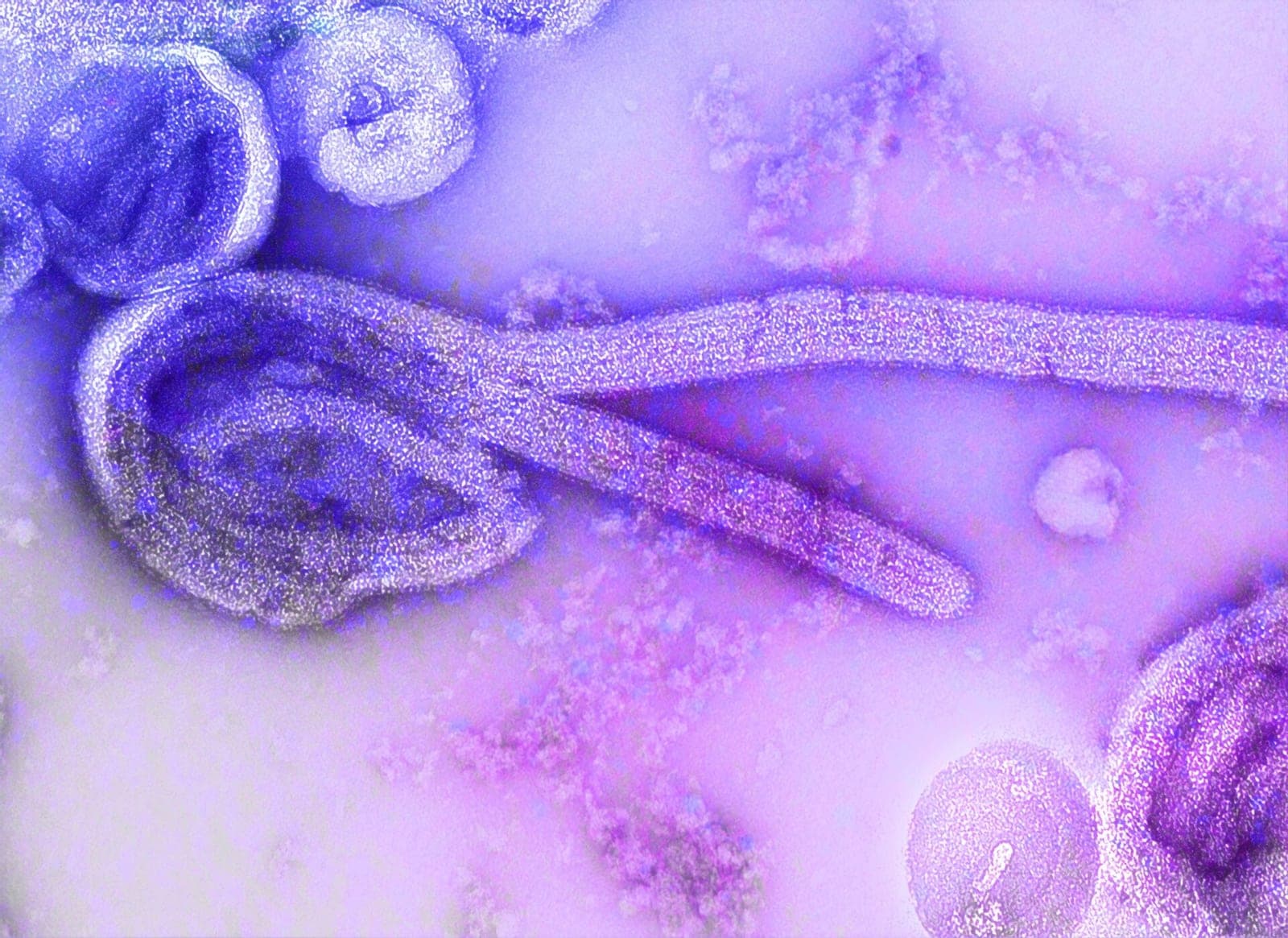 Vėl pasirodė Ebolos virusas: fiksuoti pirmieji atvejai Ugandoje