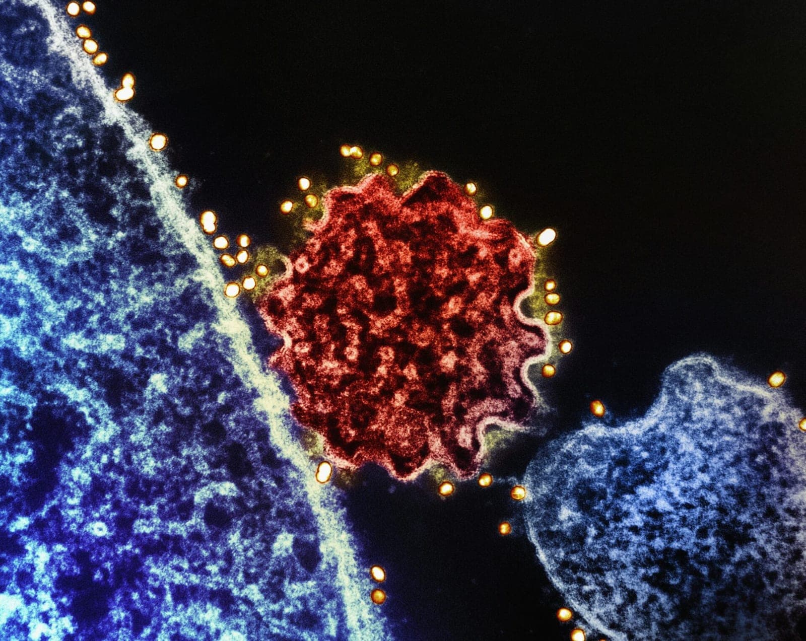 Nipah virusas dar neatėjo, bet Lietuva jau ruošiasi: vakcinos, milijonai dozių ir 95 mlrd. eurų Europos planas