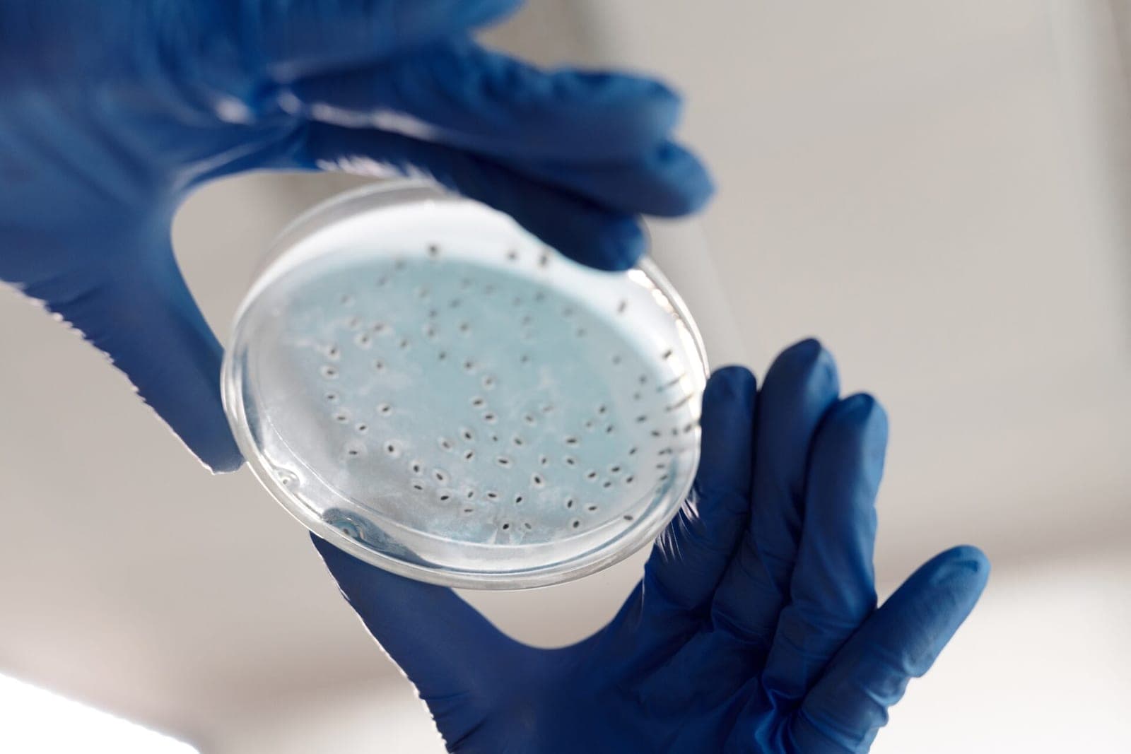 DI padėjo mokslininkams atrasti antibiotikus pavojingoms bakterijoms naikinti