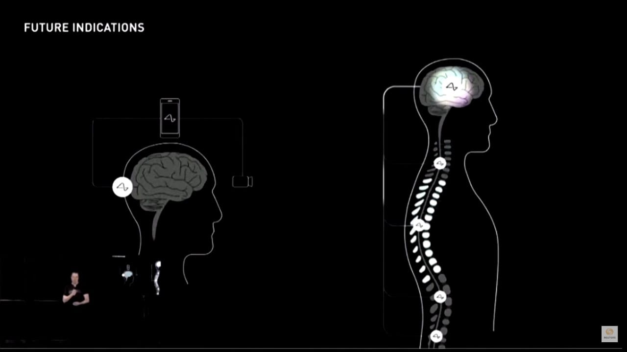 „Neuralink“